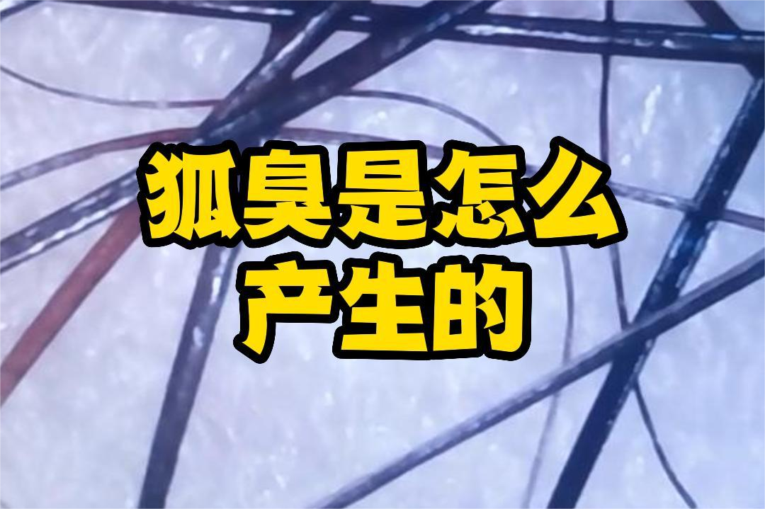 狐臭是(shì)怎麽産生(shēng)的(de)？